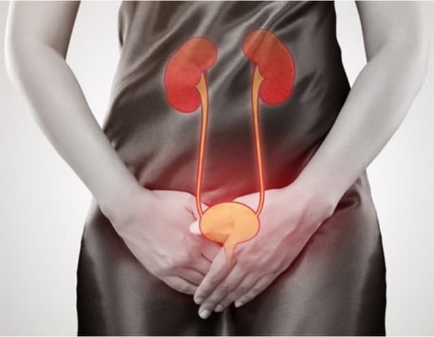 urinary tract infection image 1