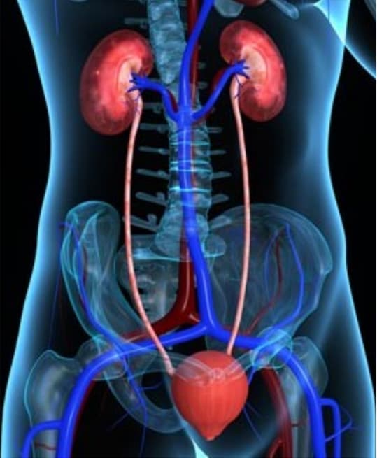 urinary tract infection image 3