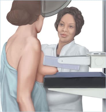 Mammography image 4