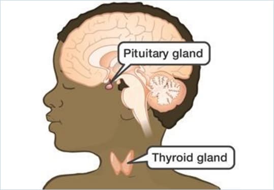 Thyroid Disease Image 2