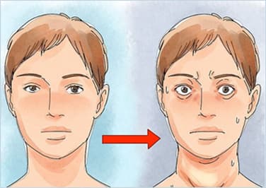 Thyroid Disease Image 6