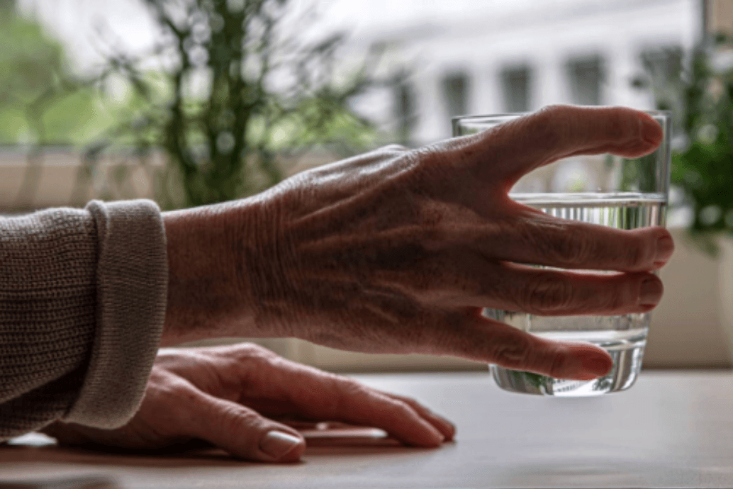 Parkinson’s Disease Image 1