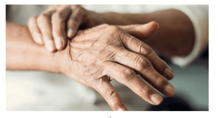 Parkinson’s Disease Image 2