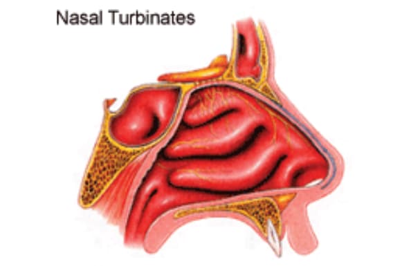 TURBINATES SURGERY image 1
