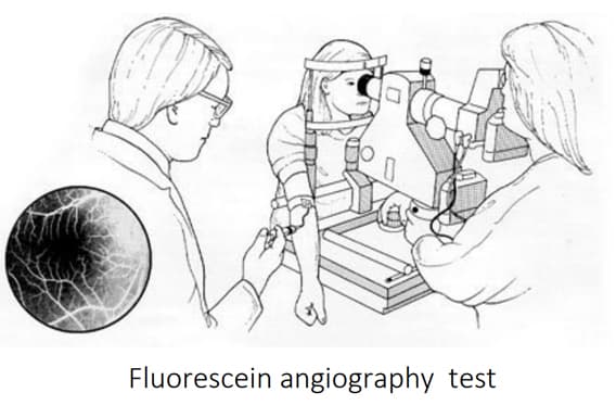 Fluorescein Angiography (FAG) Image 3
