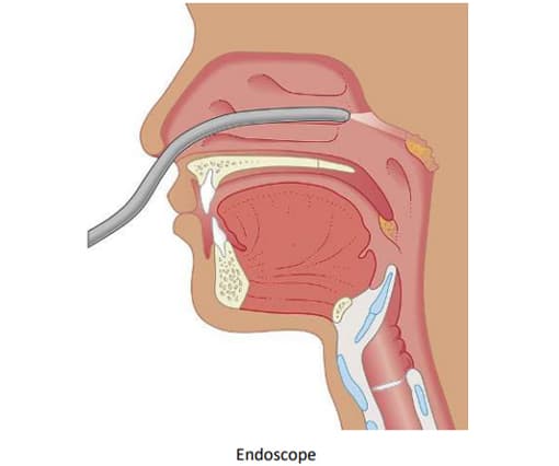NOSEBLEED image 6