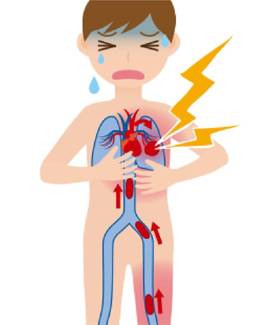 pulmonary embolism image 3