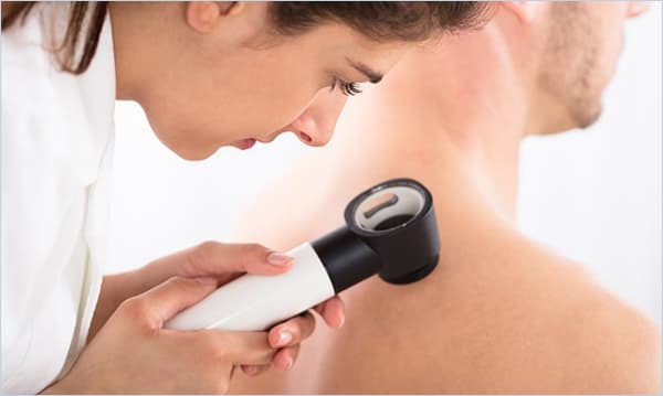 Skin Cancer Image 1