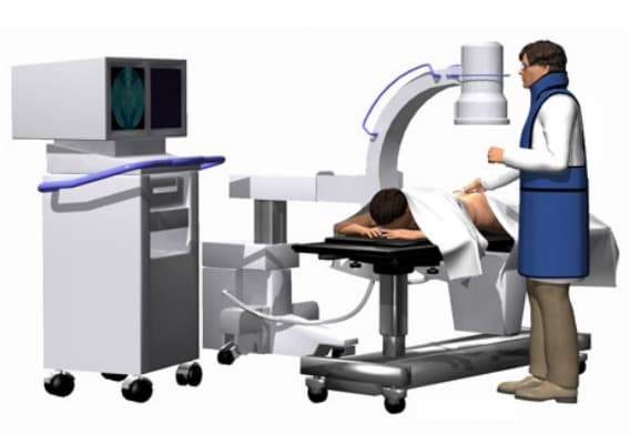 Image of fluoroscopy 1