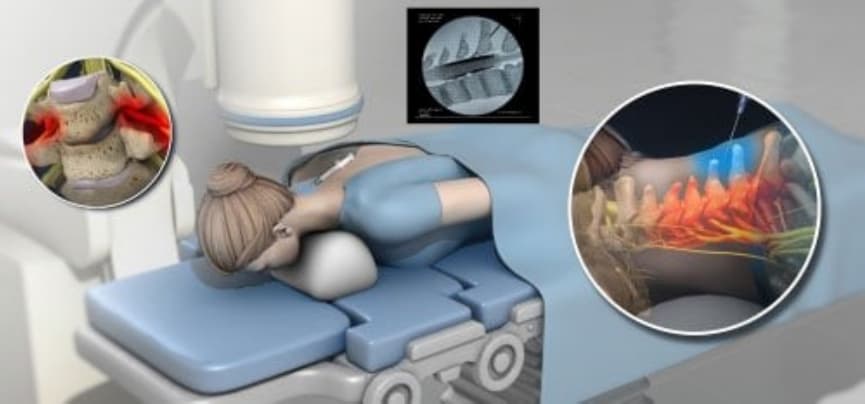 Image of fluoroscopy 6
