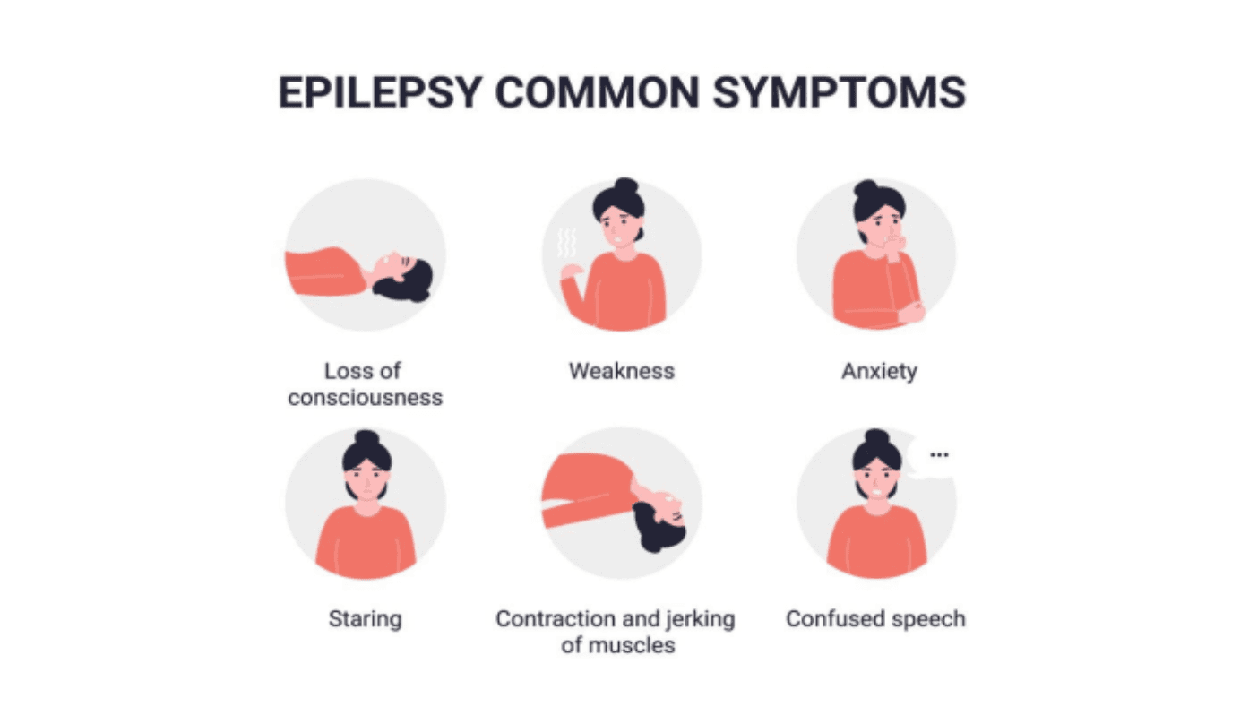Epilepsy Image 1