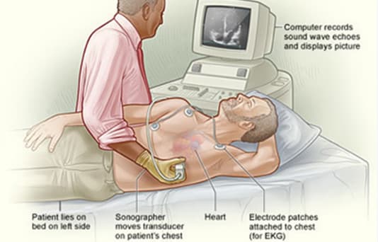 echocardiogram