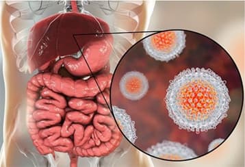 HEPATITIS Image 1