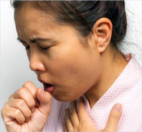 TUBERCULOSIS Image 4
