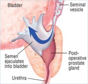 MALE INFERTILITY image 3